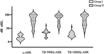 Cervical vestibular evoked myogenic potentials in 3-month-old infants: Comparative characteristics and feasibility for infant vestibular screening
